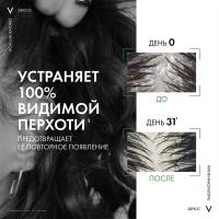 Шампунь-уход интенсивный Vichy Dercos Anti-Dandruff против перхоти, для нормальных и жирных волос, 390 мл